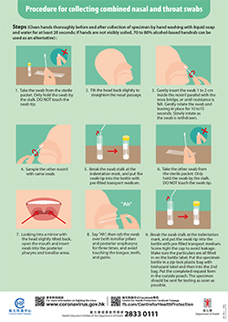 Procedure for collecting combined nasal and throat swabs
       