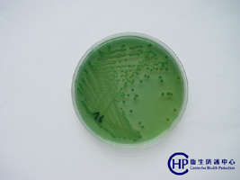 Vibrio parahemolyticus 