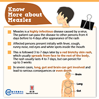 Know More about Measles