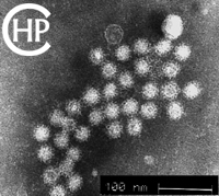 诺沃克病毒 (电子显微镜相片)