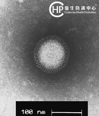 EM photo of avian flu virus